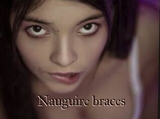 Nauguire_braces